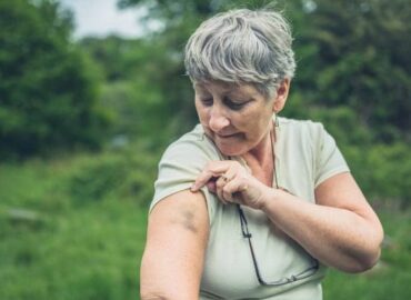 Reasons for Unexplained Bruising in Seniors